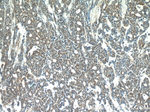 STAT5B Antibody in Immunohistochemistry (Paraffin) (IHC (P))