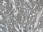 STAT5B Antibody in Immunohistochemistry (Paraffin) (IHC (P))