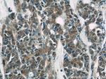 STAT5B Antibody in Immunohistochemistry (Paraffin) (IHC (P))