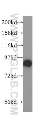 STAT5B Antibody in Western Blot (WB)