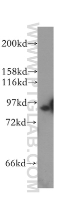 STAT5B Antibody in Western Blot (WB)