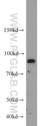 STAT5B Antibody in Western Blot (WB)