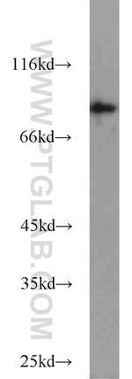 STAT5B Antibody in Western Blot (WB)