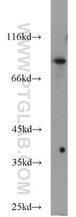 STAT5B Antibody in Western Blot (WB)