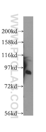 STAT5B Antibody in Western Blot (WB)