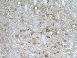 PYGB Antibody in Immunohistochemistry (Paraffin) (IHC (P))