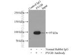 PYGB Antibody in Immunoprecipitation (IP)