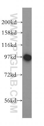 PYGB Antibody in Western Blot (WB)