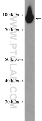 PYGB Antibody in Western Blot (WB)