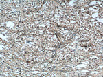 VTCN1 Antibody in Immunohistochemistry (Paraffin) (IHC (P))