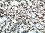 VTCN1 Antibody in Immunohistochemistry (Paraffin) (IHC (P))