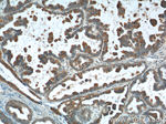 VTCN1 Antibody in Immunohistochemistry (Paraffin) (IHC (P))