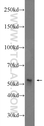 VTCN1 Antibody in Western Blot (WB)