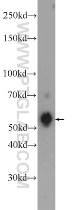 VTCN1 Antibody in Western Blot (WB)
