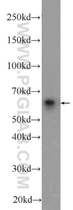 VTCN1 Antibody in Western Blot (WB)