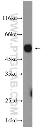 NEUROD1 Antibody in Western Blot (WB)