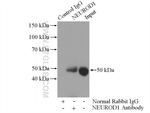 NEUROD1 Antibody in Immunoprecipitation (IP)