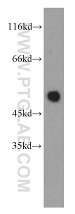NEUROD1 Antibody in Western Blot (WB)