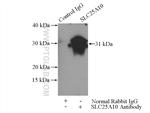 SLC25A10 Antibody in Immunoprecipitation (IP)