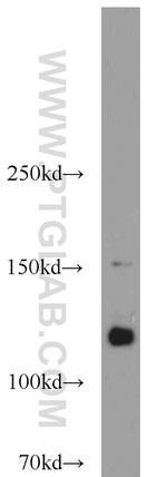 CDA1 Antibody in Western Blot (WB)