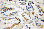 CDA1 Antibody in Immunohistochemistry (Paraffin) (IHC (P))