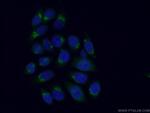 GOSR2/Membrin Antibody in Immunocytochemistry (ICC/IF)
