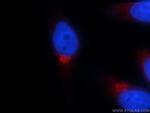 GOSR2/Membrin Antibody in Immunocytochemistry (ICC/IF)