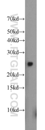 GOSR2/Membrin Antibody in Western Blot (WB)