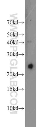 GOSR2/Membrin Antibody in Western Blot (WB)