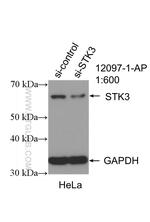 STK3 Antibody in Western Blot (WB)