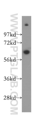 STK3 Antibody in Western Blot (WB)