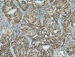 PBXIP1 Antibody in Immunohistochemistry (Paraffin) (IHC (P))