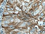 PBXIP1 Antibody in Immunohistochemistry (Paraffin) (IHC (P))