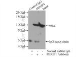 PBXIP1 Antibody in Immunoprecipitation (IP)