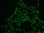 SPIN1 Antibody in Immunocytochemistry (ICC/IF)