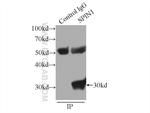 SPIN1 Antibody in Immunoprecipitation (IP)