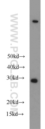 SPIN1 Antibody in Western Blot (WB)