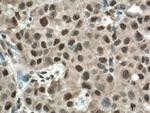 BCOR Antibody in Immunohistochemistry (Paraffin) (IHC (P))