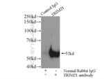 TRIM21 Antibody in Immunoprecipitation (IP)