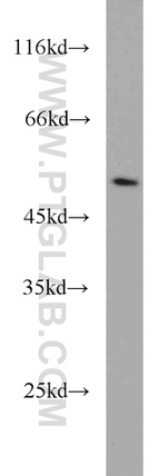 TRIM21 Antibody in Western Blot (WB)