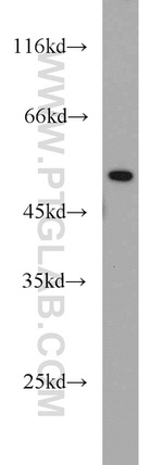 TRIM21 Antibody in Western Blot (WB)