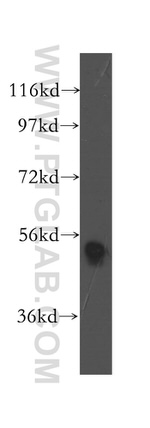 TRIM21 Antibody in Western Blot (WB)