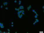 PADI2 Antibody in Immunocytochemistry (ICC/IF)