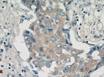 PADI2 Antibody in Immunohistochemistry (Paraffin) (IHC (P))