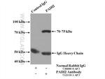 PADI2 Antibody in Immunoprecipitation (IP)