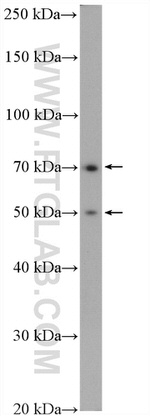 PADI2 Antibody in Western Blot (WB)