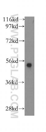 PADI2 Antibody in Western Blot (WB)