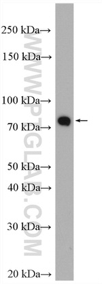 PADI2 Antibody in Western Blot (WB)