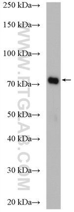 PADI2 Antibody in Western Blot (WB)