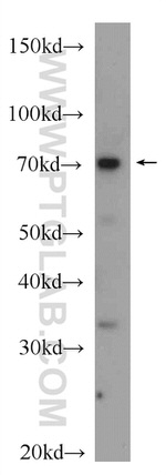 PADI2 Antibody in Western Blot (WB)